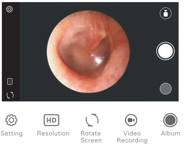 AKNTE100i-Ear-Wax-Removal-Tool-fig-9