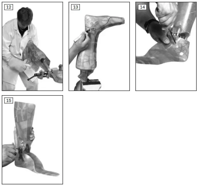 ottobock 17AD1 Multifunctional Ankle Joint - Product Overview 5