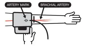 microlife BP B3 AFIB Advanced Blood Pressure Machine-- Place the artery