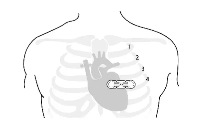Fuzhou-Wenxin-Electronics-Technology-HR-0542F-Cardiac-Monitor-12