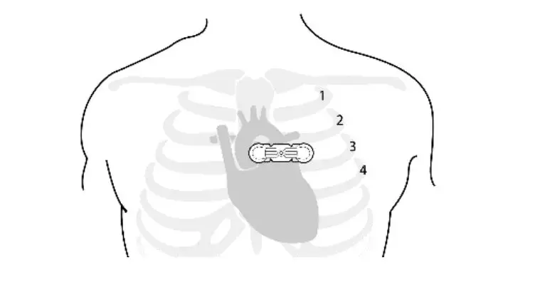 Fuzhou-Wenxin-Electronics-Technology-HR-0542F-Cardiac-Monitor-13