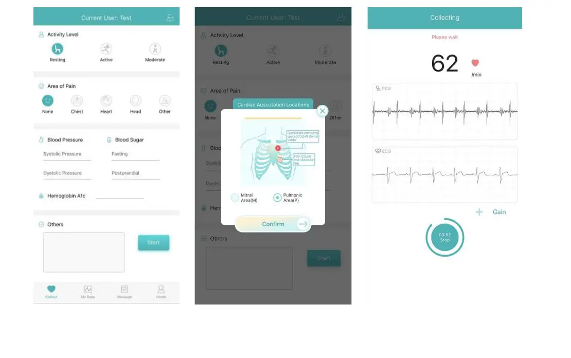 Fuzhou-Wenxin-Electronics-Technology-HR-0542F-Cardiac-Monitor-20