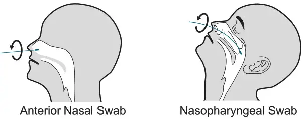 Status P 5383 A COVID 19Flu A& B - SAMPLE COLLECTION