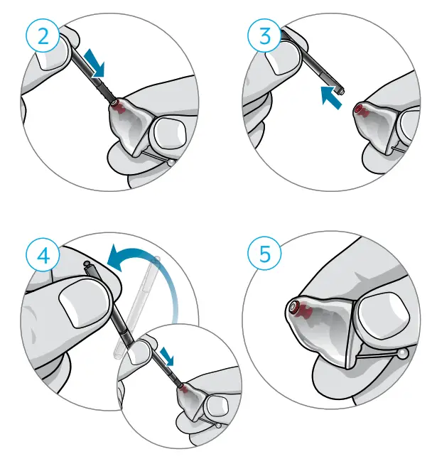 Starkey In-the-Ear Custom Rechargeable - Changing Hear Clear Wax Guards
