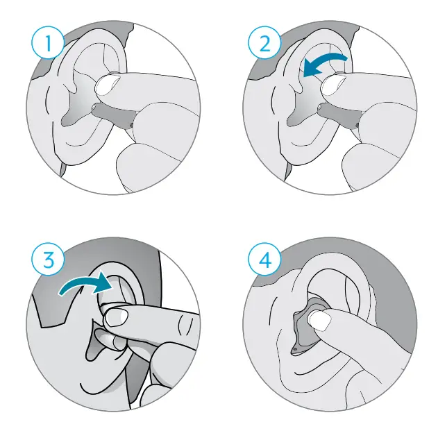 Starkey In-the-Ear Custom Rechargeable - I nsertion and Removal