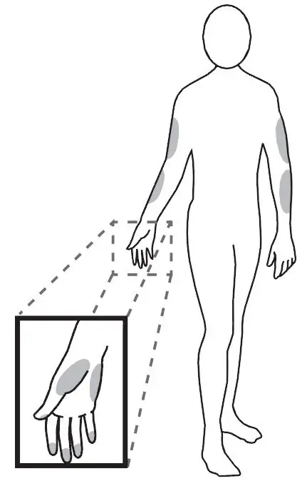 FORA-G40-Blood-Glucose-Monitoring-System-FIG-18