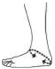 Push Ankle Foot Orthosis -2