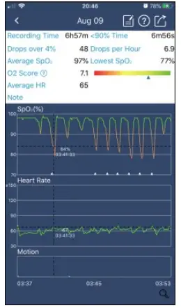 Review Measured Values