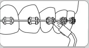 Operating Instructions