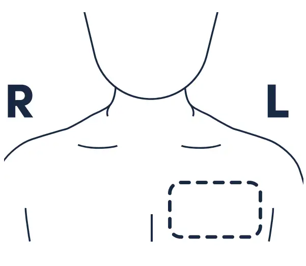 Locating the biobutton