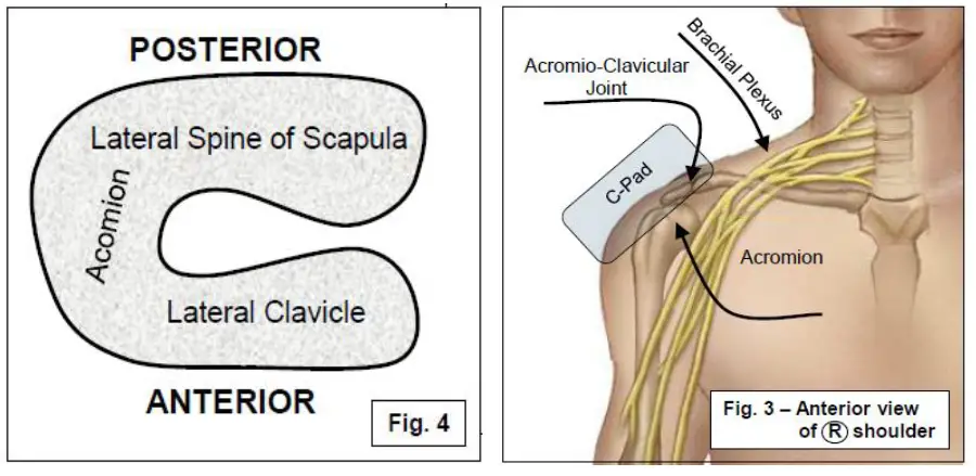 AMATECH F-63500 Shoulder Supports FIG 4
