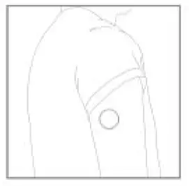 Accuralink Technologies iGMS-QT System Kit FIG2