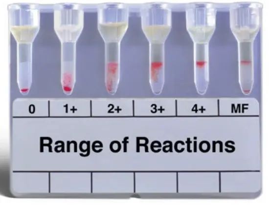 Micro Typing System MTS084024 Anti-Human Globulin - Diagram 1