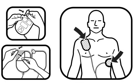 defibtech DDU-100 Semi-Automatic External Defibrillator 2