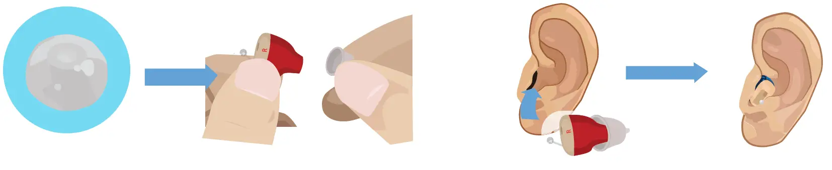 NANO-CIC-Rechargeable-Hearing-Aids-4