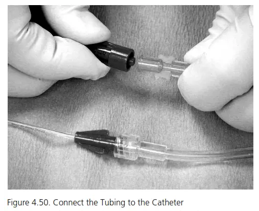 ZOLL 601285 001 IVTM Intravascular Temperature Management - fig19