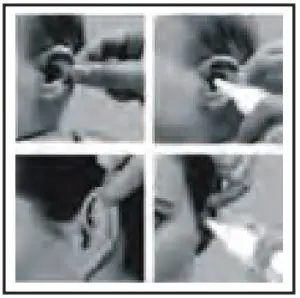 TRULY TET 351 Clinical Infrared Thermometers - pull the ear