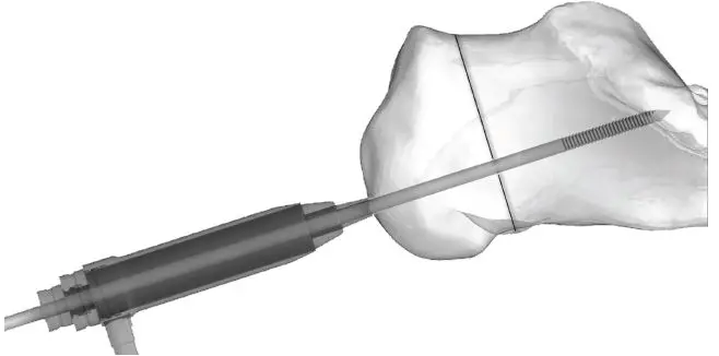 Instructions for Use 2