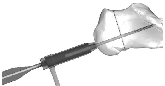 Instructions for Use 3