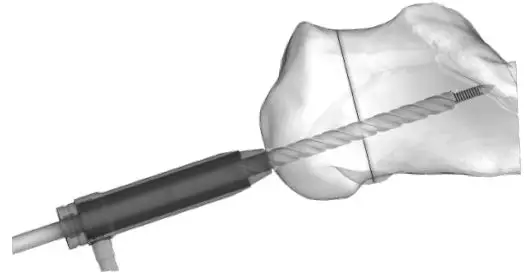 Instructions for Use 4