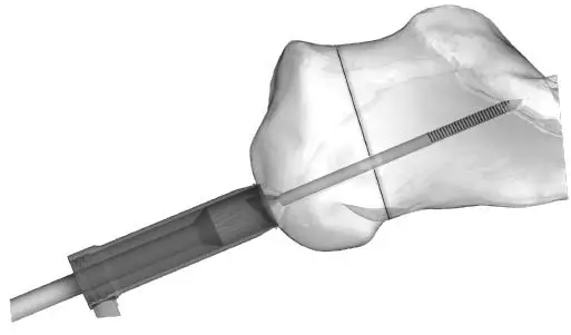 Instructions for Use 5