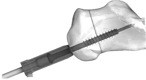 Instructions for Use 6