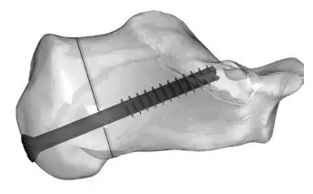 Instructions for Use 7