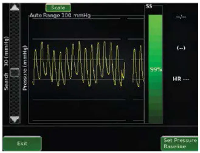 BASELINE CALIBRATION