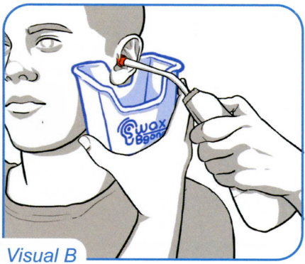 waxBgone Earwax Irrigation Kit - 3