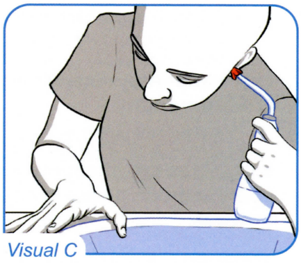 waxBgone Earwax Irrigation Kit - 4