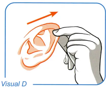 waxBgone Earwax Irrigation Kit - 5