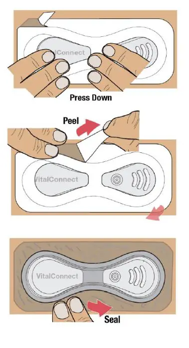 VitalConnect-Platform-Disposable-Patch-Monitor-Vitals-fig12