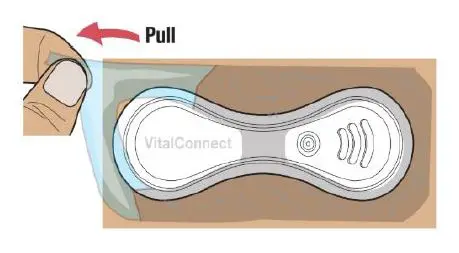 VitalConnect-Platform-Disposable-Patch-Monitor-Vitals-fig15