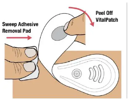 VitalConnect-Platform-Disposable-Patch-Monitor-Vitals-fig16