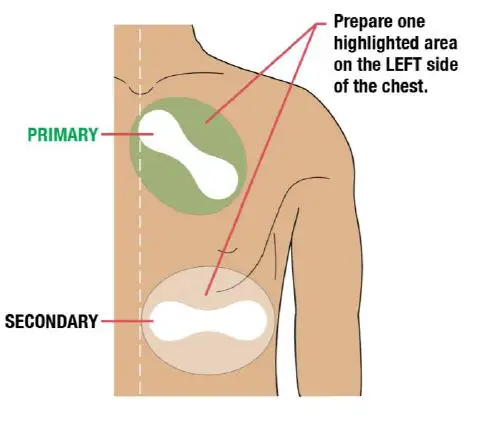 VitalConnect-Platform-Disposable-Patch-Monitor-Vitals-fig4