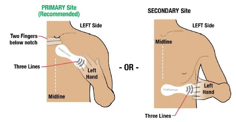 VitalConnect-Platform-Disposable-Patch-Monitor-Vitals-fig6