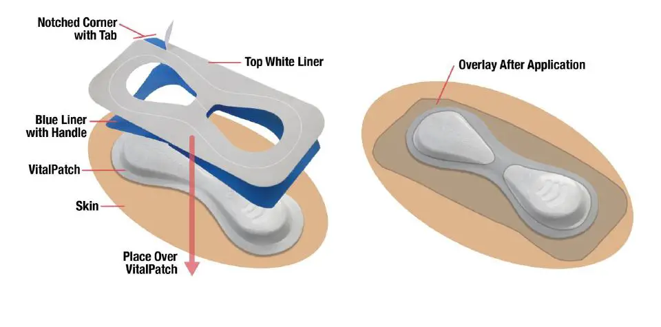 VitalConnect-Platform-Disposable-Patch-Monitor-Vitals-fig9