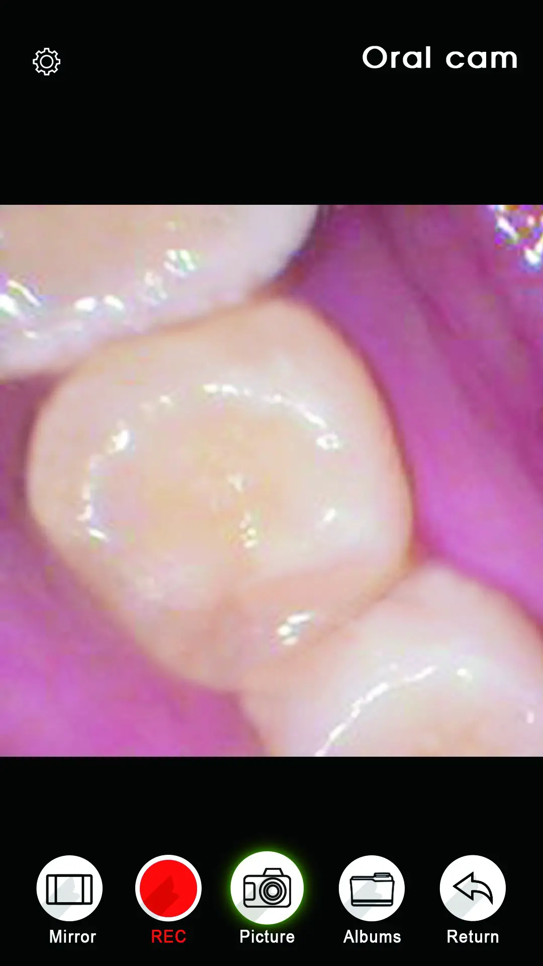 Oral ES10Pro Smart WiFi Dental Camera - Figure 3