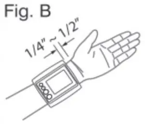 FIG 17 APPLYING THE CUFF