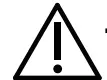 Warning Icon