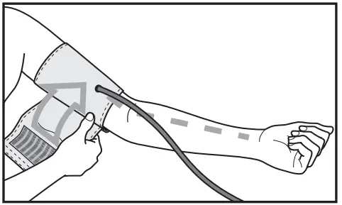 Attaching the cuff