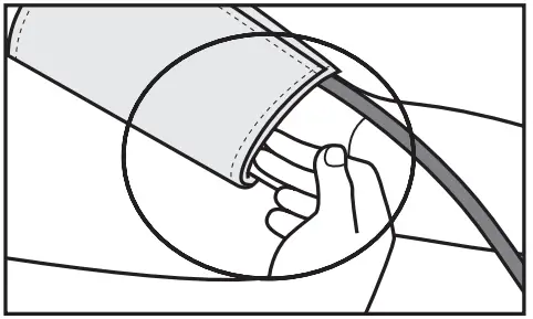 Attaching the cuff