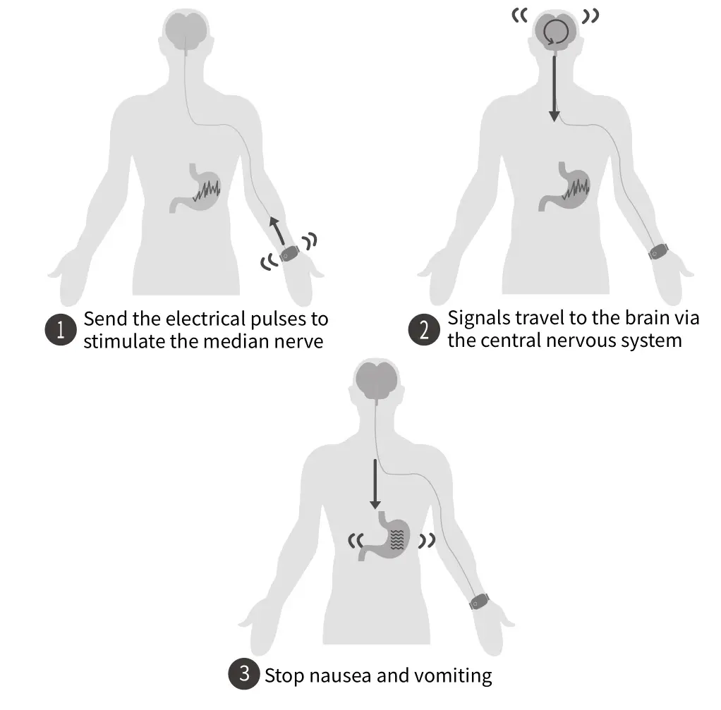 Emeterm TENS targeted Neuromodulation Instruction Manual-Operating principles