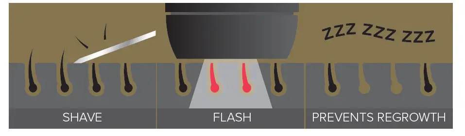 SMOOTHSKIN pure Fit IPL 2