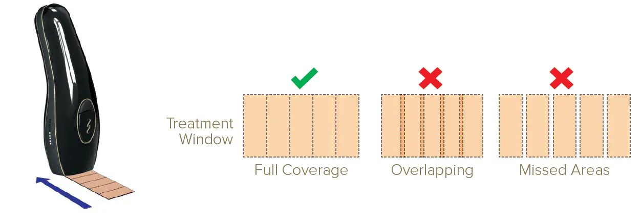SMOOTHSKIN pure Fit IPL 8