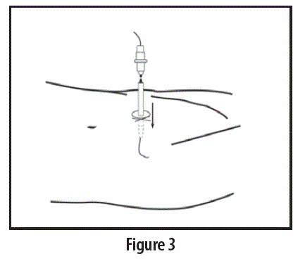 Teleflex AK-09000 Vascular Access Product Catalog FIG 3