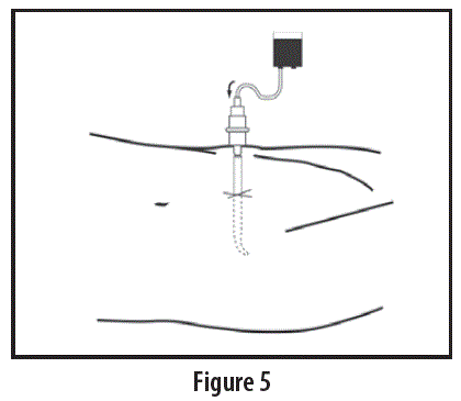 Teleflex AK-09000 Vascular Access Product Catalog FIG 5