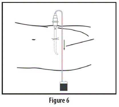 Teleflex AK-09000 Vascular Access Product Catalog FIG 6