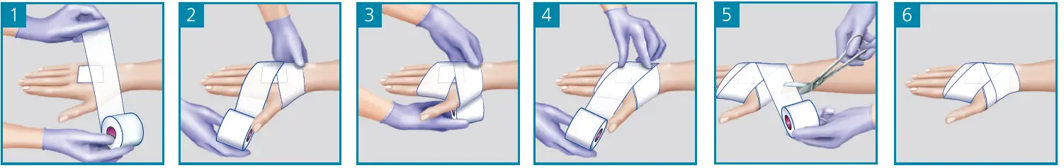 HARTMANN-4049500750080-Peha-haft-Cohesive-Conforming-Bandage-FIG-2