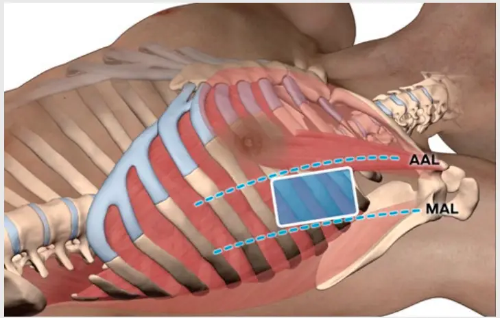 SAM MEDICAL TS200 5P EN Position Align Vent - fig 2